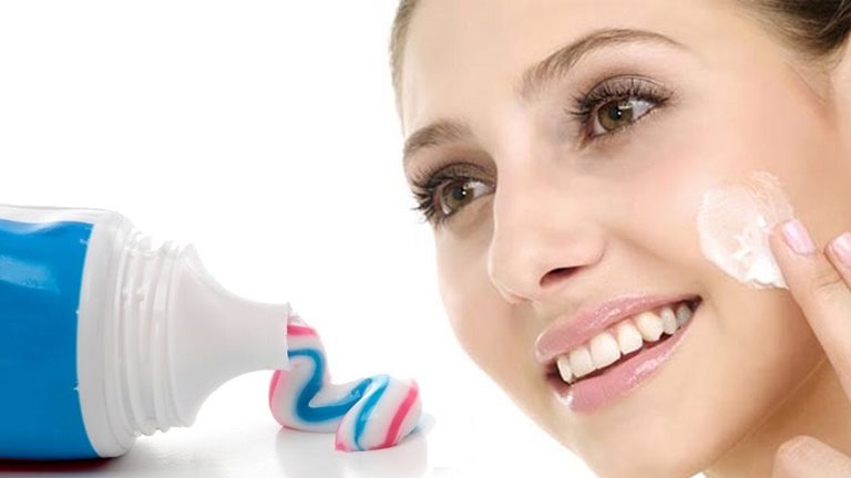 Cách trị tàn nhang bằng kem đánh răng hiệu quả